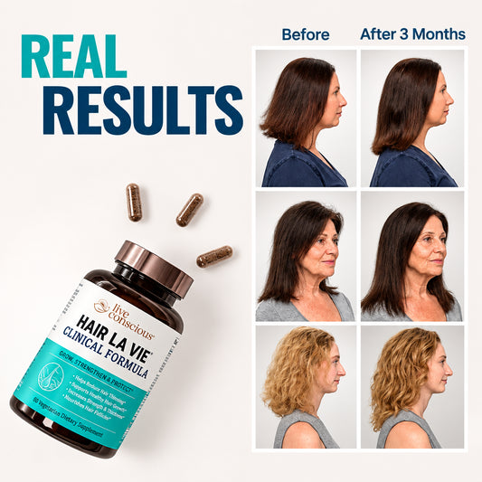 Hair La Vie Clinical Formula Hair Vitamins – 90 Capsules