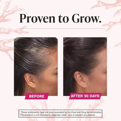 Viviscal Professional Hair Growth Supplement – 180 Tablets