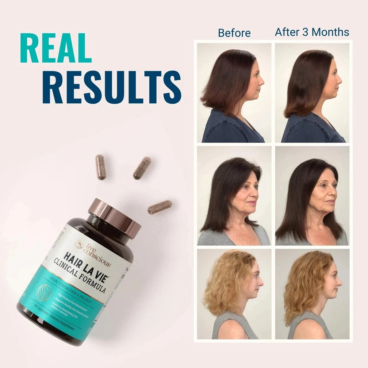 Hair La Vie Clinical Formula Hair Vitamins – 90 Capsules